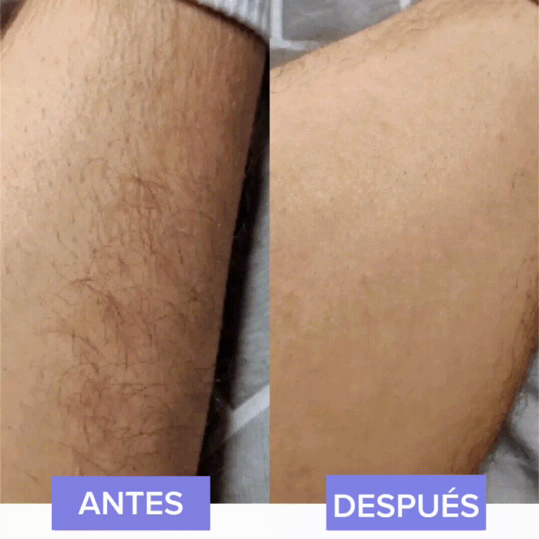 Savose™ Depilador beauty pro